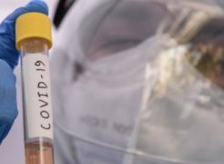 A precisão e confiabilidade de resultado do teste clínico: Uma análise metrológica e estatística do COVID-19